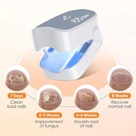 HealthNail Pro™ - Nail Fungus Laser Device