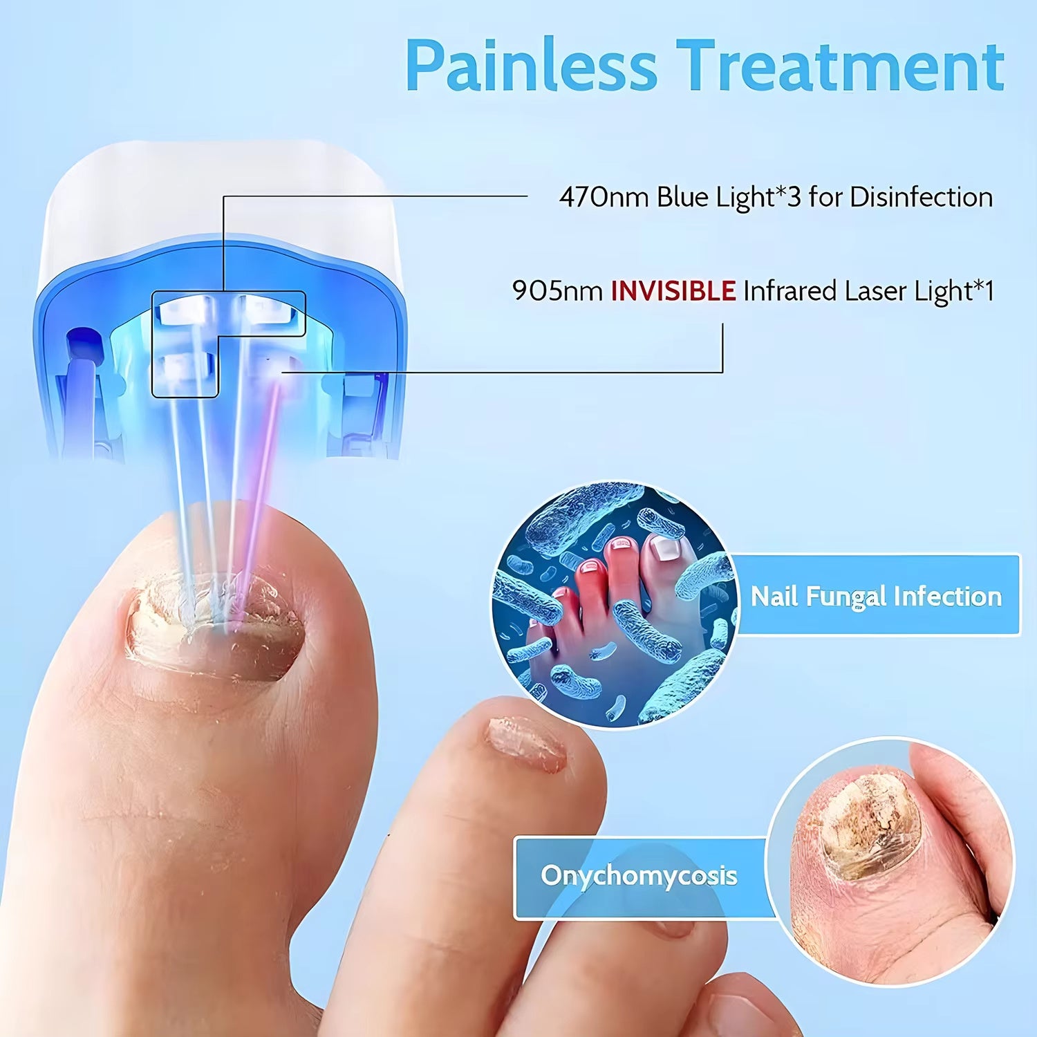 HealthNail Pro™ - Nail Fungus Laser Device