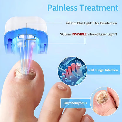 HealthNail Pro™ - Nail Fungus Laser Device